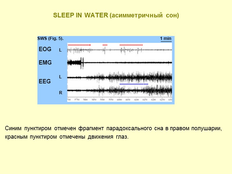 SLEEP IN WATER (асимметричный сон) Синим пунктиром отмечен фрагмент парадоксального сна в правом полушарии,